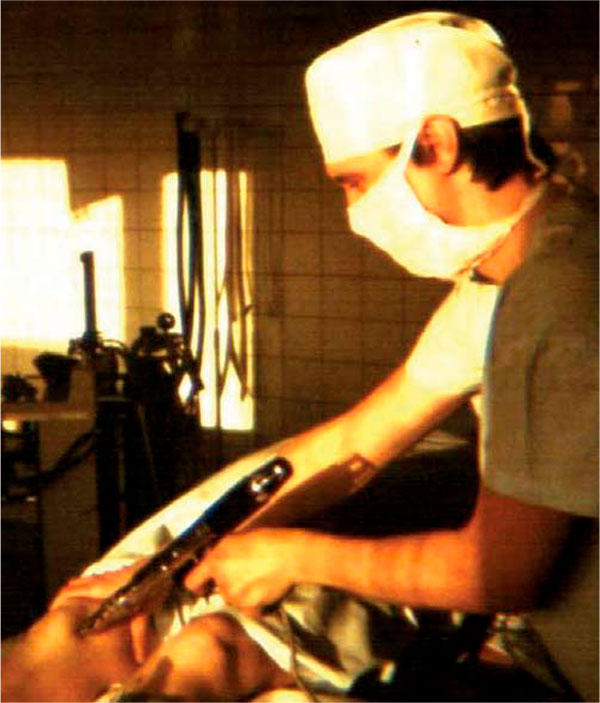 Рисунок 1. Техника выполнения игольно-струйной инъекции в коленный сустав с помощью аппарата «ИСИ-1»